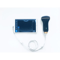 MT-Medical High Specification Convex Probe Portable Handheld USB Ultrasound Scanner price